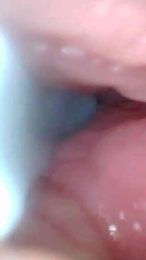 First time: An endoscope reveals the G-spot up close - without mountingl | Clip 1