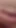 Penis başı enoki mantarlarıyla kaplı