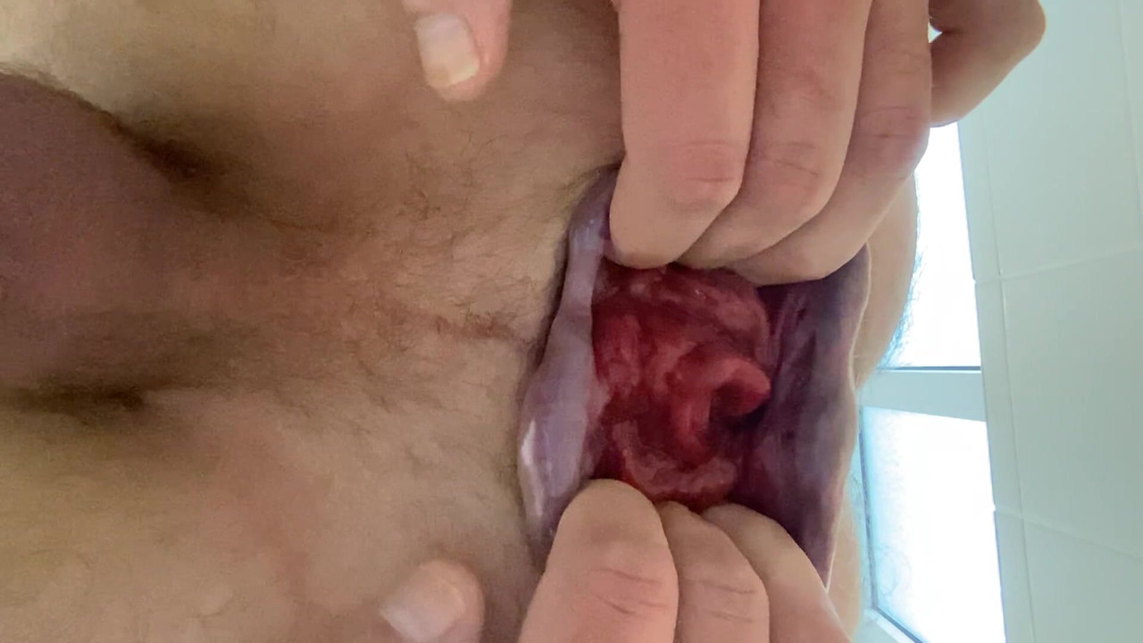 Great Anal Gape And Huge Rose!