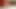 弱虫学校ふしだらな女アナル（パート1）