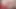 Hotkinkyjo im schwarzen kleid nimmt tonnen von quallen in ihren arsch und analprolaps extrem