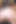 Rahim ağzı sarkması üvey nine anal yumrukla sikiliyor