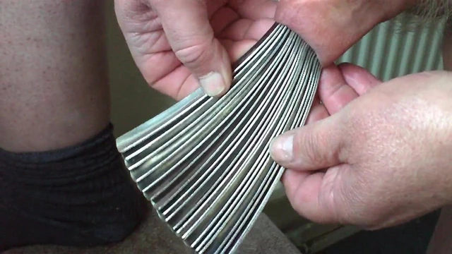 Foreskin stretched with 20 spoons