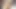 Liquidfire ohmibod: hisler