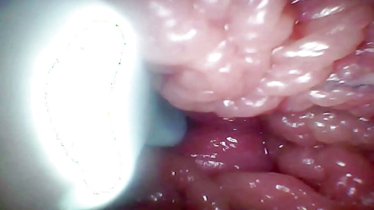 Camera endoscop înregistrează punctul G al soției mele. Videoclip educațional de aproape