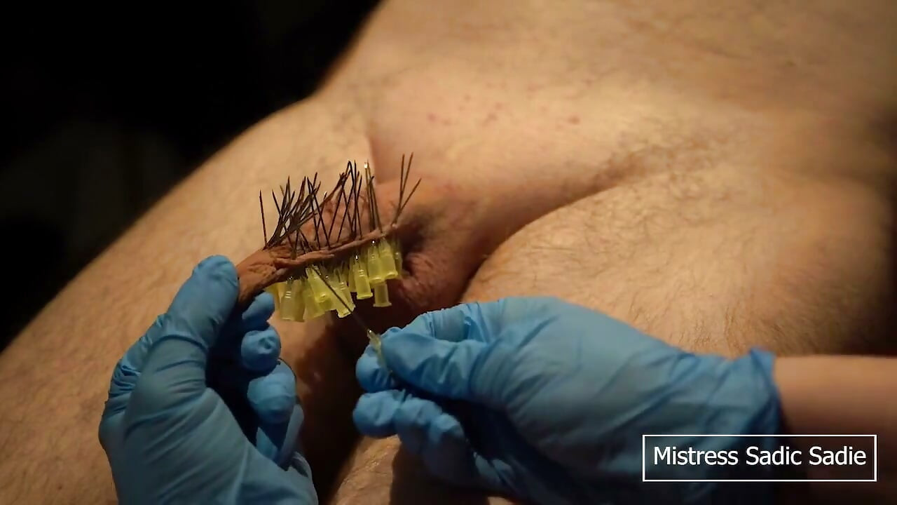 107 Needles CBT