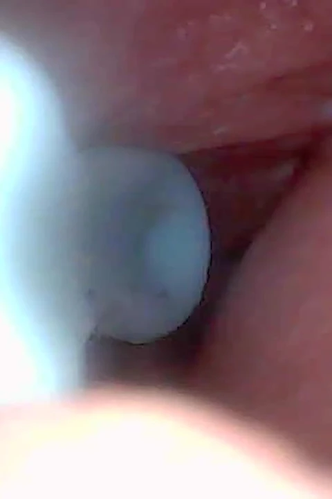 Let's Take a Peek Into My Juicy Pussy Together (endoscope Camera)