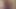 アリソン