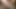 BiggDick penis Amateur USA America pornvideo young mole BigDick my molepenis teen compilation solo masterbation amateur reality