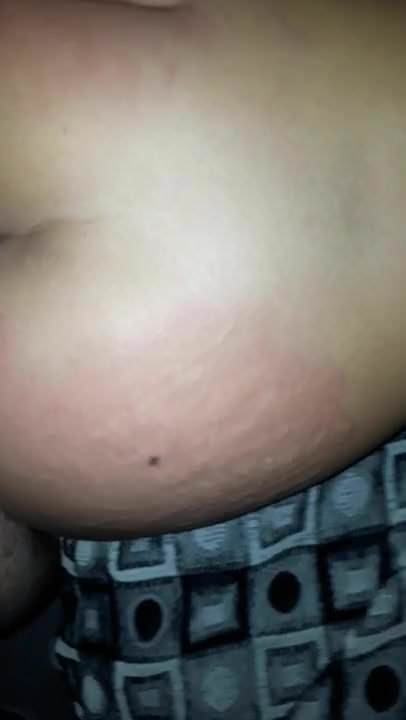 Las nalgas rojas