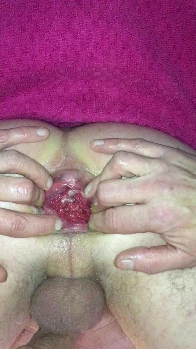 Wet, gaping, prolapsing stretched arse with an Aubergine.