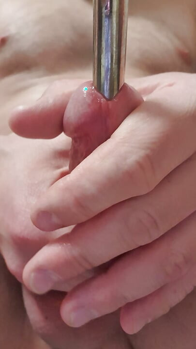 Extremely stretched hole after dilator play