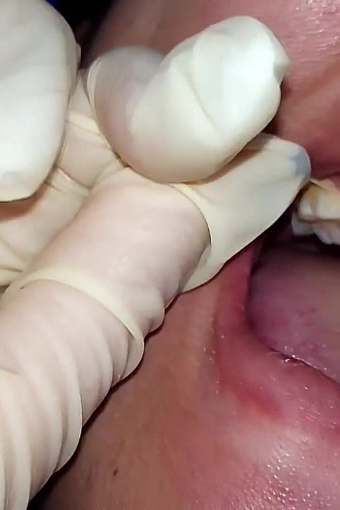 Tentando usar fio dental (close-up)