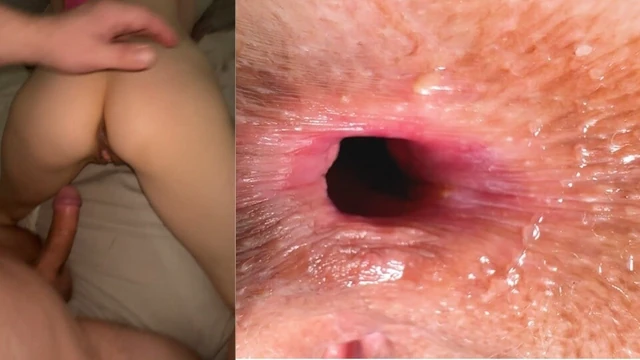 Stepdaughter farted in my nose. Hm I didn’t think she wants my inheritance