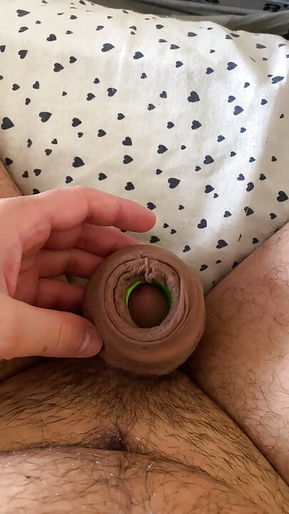 Inflate foreskin stretching
