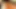 Eros exotica hd: ilk aşk (hd): bölüm 9