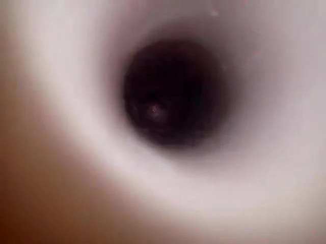 Inside the anus 2