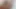 Lizzy Yum november 2023 solo masturbation #2 (vulva dream) Post Op Orgasm Pussy Masturbation