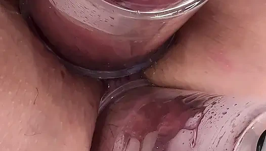 Extreme Anal and Pussy Pumping Fall 2025