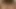 teaser