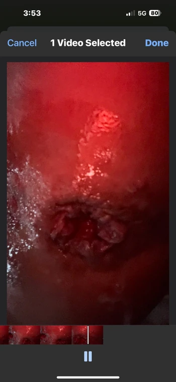 Whore with extreme sloppy blown out cunt and asshole