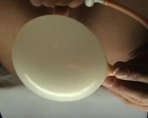 Analballoon Vol.1
