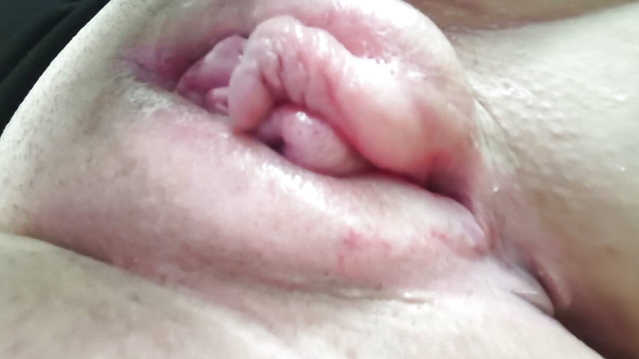 Lồn sưng phồng