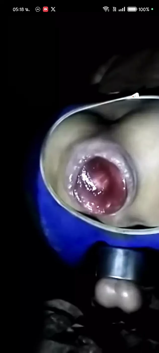 Sex toy in