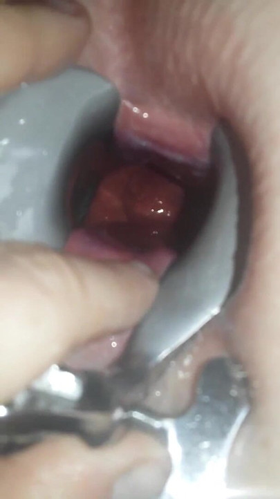 딜도로 후장 빨기