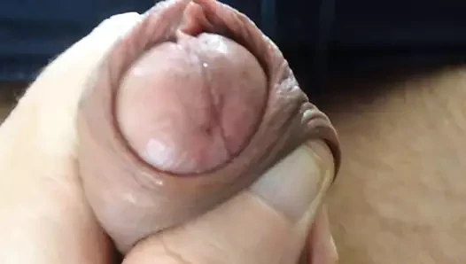 Spuiten