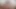 Lizzy Yum VR August 2023 Just Relaxing #1 Post Op Orgasm Pussy Masturbation Teasing