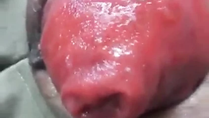 anal prolapsus