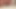 Sounding a 15-16 mm Hegar sounding rod completely