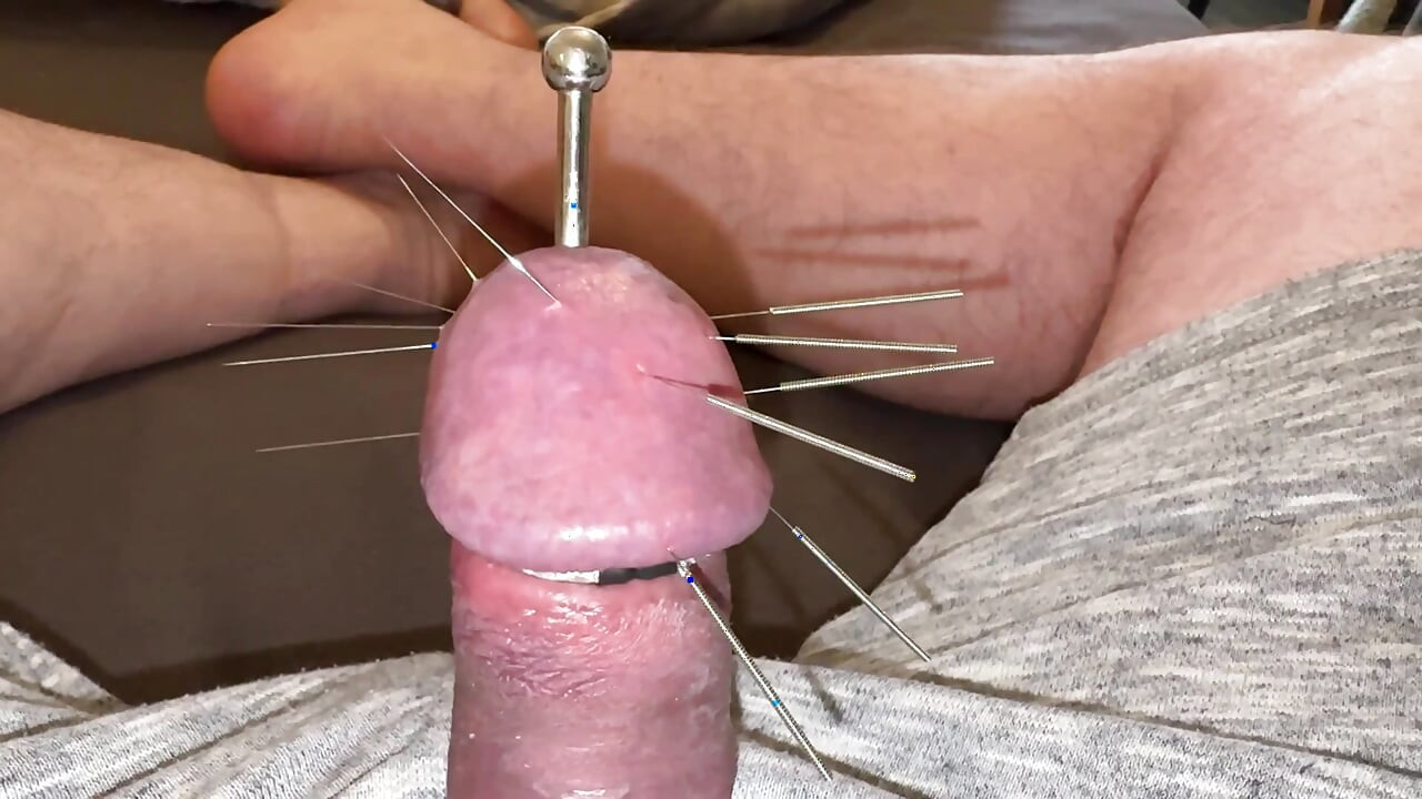 Seven long needles and an orgasm!