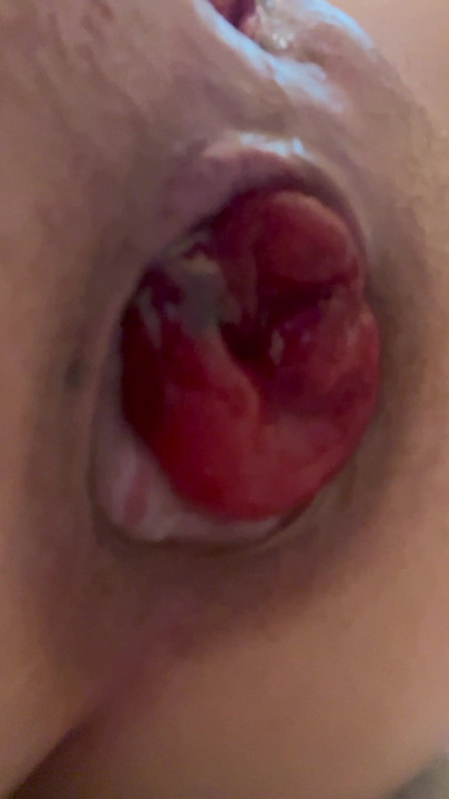 protruding rectum