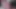 Intense Lesbian Masturbation: Vibrator on Swollen Pussy