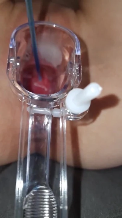 Momento poderoso de "Esperma diretamente no útero"