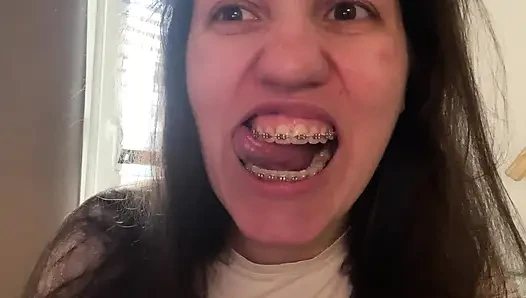 Licking Your Braces with Your Tongue
