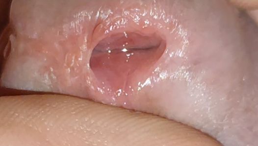 Preparare il pulcino per l'inserimento del tubo con il siero anestetico.