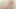 Biokinese - Erhöhen Sie Ihren Penis in 30 Zentimetern (12 Zoll)