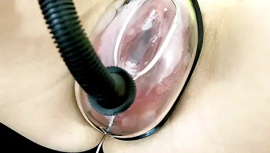 Vaginal Deformation Under the Influence of a Vacuum Pump