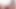الشرج غير المتوقع SCN5