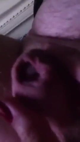 Surprises in foreskin