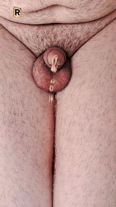 My wet penis is urinating."