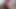セクシーな交差。「ビトウィーン」参照