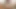Lizzy Yum July 2023 JUST my DILATOR Post-Op Orgasm Pussy Clit Masturbation Teasing Orgasm