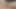 Irumasi tenggorokan dalam x ngentot 3 lubang! Anus perawan meluas, gadis anal cantik ran