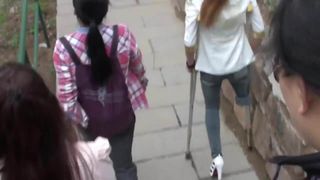 被截肢的中国女孩拄着拐杖下楼梯