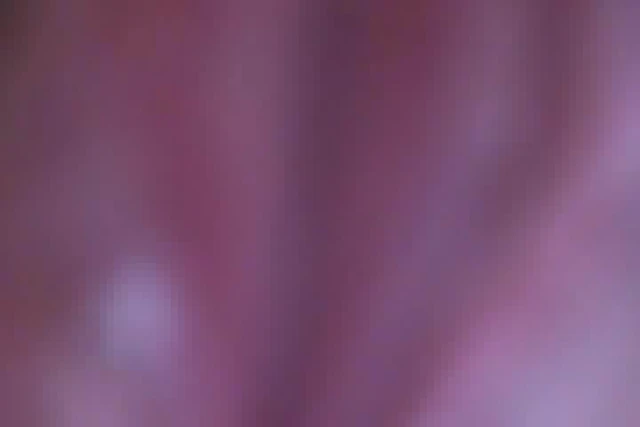 Upclose