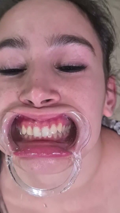 French maid tries to swallow her own piss through lip retractor | Clip 2